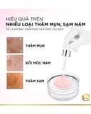 Dưỡng Chất Sáng Da L’Oréal Paris Glycolic-Bright